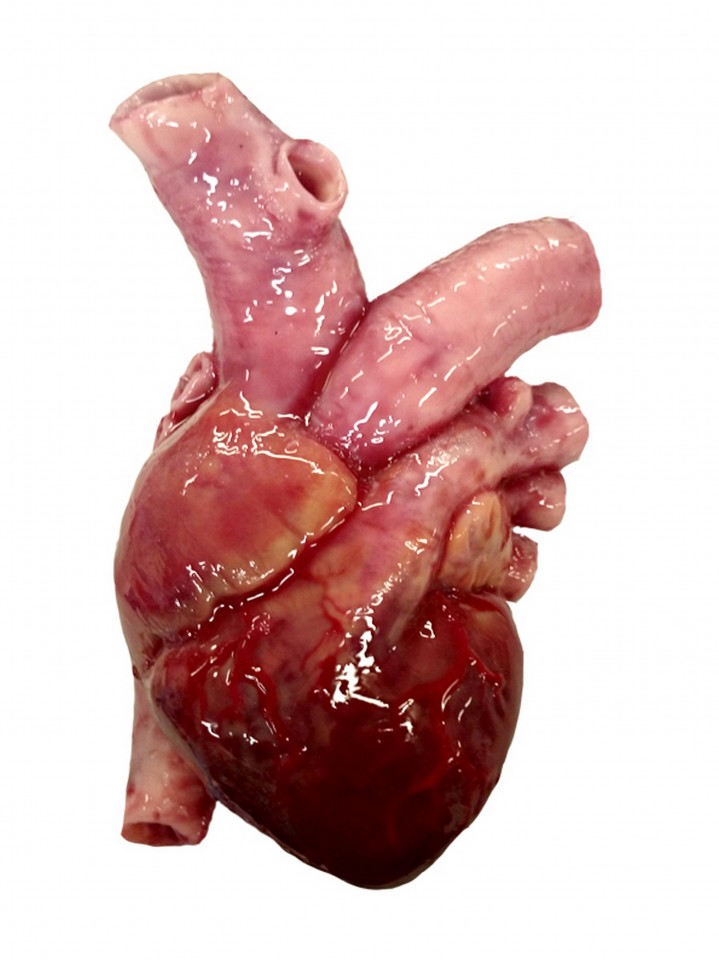 new heart_Dr Richard Arm