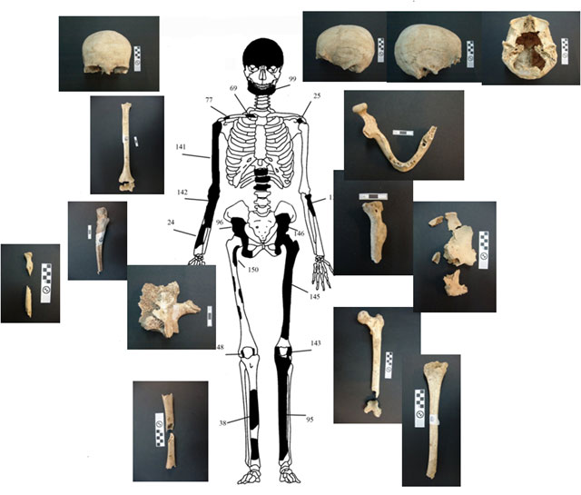 Εικόνα 1: Ενδεικτική εκπροσώπηση οστών Ατόμου 1 