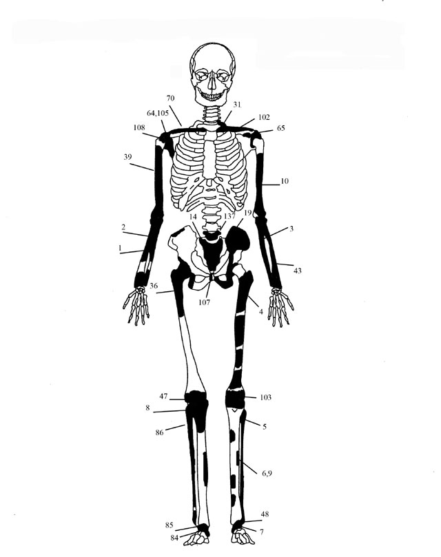 Εικόνα 2: Ενδεικτική εκπροσώπηση οστών Ατόμου 1 με φωτογραφίες οστών 