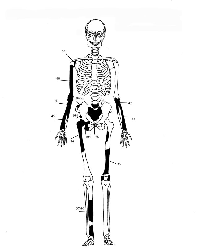 Εικόνα 4: Ενδεικτική εκπροσώπηση οστών Ατόμου 2 με φωτογραφίες οστών 