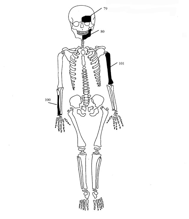 Εικόνα 6: Ενδεικτική εκπροσώπηση οστών Ατόμου 3 με φωτογραφίες οστών 