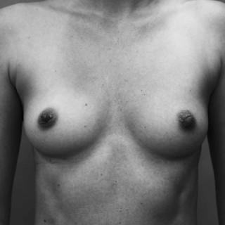 Τούτο εστί το στήθος μου