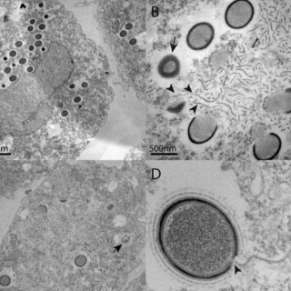 Άγνωστος προϊστορικός ιός βρέθηκε κατεψυγμένος σε γκουλάγκ στη Σιβηρία