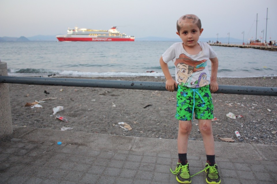 Σεπτέμβριος 2015: Ο Αντνάν, πέντε χρονών, είναι από το Χαλέπι της Συρίας. Μαζί με τη μητέρα, τον πατέρα, τους παππούδες, τη μικρότερη αδελφή του και το τεσσάρων μηνών μωρό της οικογένειας, ο Αντνάν κοιμόταν στο έδαφος στην πόλη της Κω για εννέα νύχτες. Πριν από περίπου 18 μήνες, μια βόμβα χτύπησε το σπίτι του. Ο Αντνάν ήταν μόνος στο δωμάτιό του εκείνη την στιγμή και τραυματίστηκε σοβαρά. Η θεία του και δύο ξαδέλφες του σκοτώθηκαν κατά την έκρηξη. Η μητέρα του έπαθε σοβαρά εγκαύματα. © Alva White/MSF