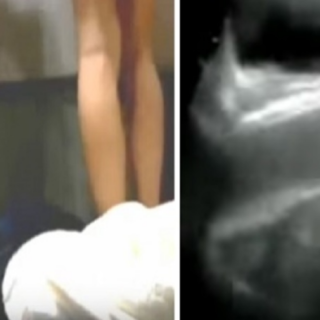 Έτσι φαίνεται το σεξ μέσα από μαγνητική τομογραφία