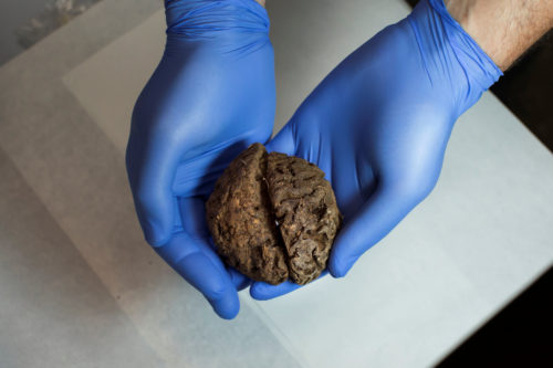 Δεκάδες φυσικά διατηρημένοι εγκέφαλοι ανακαλύφθηκαν σε μαζικό τάφο της εποχής της Ισπανικού Εμφυλίου