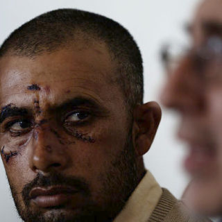 Ετήσιο ρεκόρ οι ρατσιστικές επιθέσεις στον Ασπρόπυργο