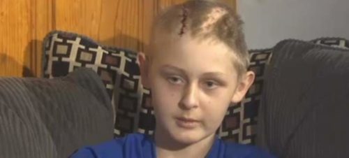 ΗΠΑ: 13χρονος ξύπνησε από κώμα μόλις οι γονείς επέτρεψαν τη δωρεά οργάνων του