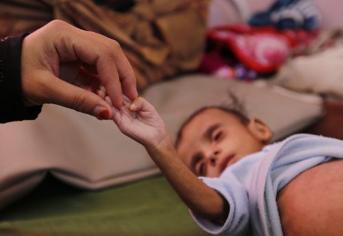 ΟΗΕ: Οκτώ παιδιά σκοτώνονται ή τραυματίζονται καθημερινά στην Υεμένη