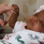 Το μικρότερο μωρό στον κόσμο βγήκε από το νοσοκομείο υγιές