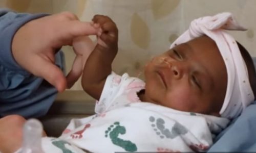 Το μικρότερο μωρό στον κόσμο βγήκε από το νοσοκομείο υγιές