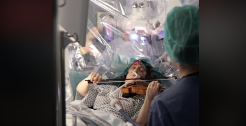 Βίντεο που συγκλονίζει: Μουσικός έπαιζε βιολί, όσο της έκαναν χειρουργείο στον εγκέφαλο