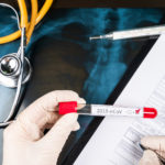 Κορονοϊός: Πρώτα κρούσματα σε Βατικανό, Σερβία,  Καμερούν και Μπουτάν