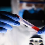 Κορονοϊός: Πρώτο κρούσμα στην Νότιο Αφρική