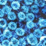 Βραζιλιάνος ασθενής φαίνεται να είναι ο πρώτος στον κόσμο που θεραπεύθηκε από τον ιό HIV μόνο με φάρμακα