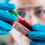 Covid-19 – Γερμανία: Ξεκίνησαν οι κλινικές δοκιμές σε εμβόλιο κατά του κορονοϊού