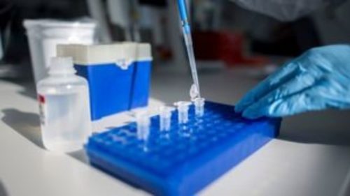 Κορωνοϊός: Στα εργαστήρια προσπαθούν να δημιουργήσουν ειδικά αντισώματα που αδρανοποιούν τον ιό