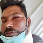 Ηλεία: Ξυλοδαρμός μετανάστη-εργάτη. Καταγγελίες για «πρακτικές Μανωλάδας»