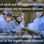 Με επικεφαλής Έλληνα, επιστημονική ομάδα δημιούργησε τον πρώτο στον κόσμο χοληδόχο πόρο