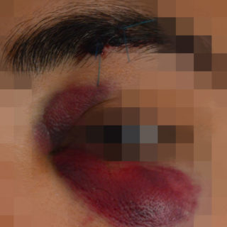 Αστυνομική βία: «Με παράτησαν γιατί νόμιζαν πως ήμουν νεκρός»