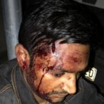 Δολοφονική επίθεση φασιστών εναντίον τριών μεταναστών καταγγέλλει η ΚΕΕΡΦΑ