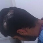 Κρήτη: Εργάτης ζήτησε τα δεδουλευμένα του κι ο εργοδότης του τον ξυλοκόπησε βάναυσα