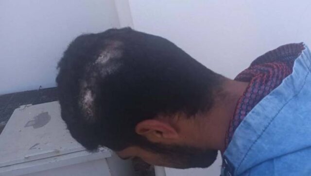 Κρήτη: Εργάτης ζήτησε τα δεδουλευμένα του κι ο εργοδότης του τον ξυλοκόπησε βάναυσα