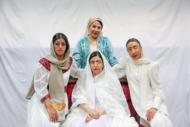 Ιράν: Σχεδιάστρια μόδας επιλέγει ως μοντέλα γυναίκες που έπεσαν θύματα επιθέσεων με οξύ [ΕΙΚΟΝΕΣ]