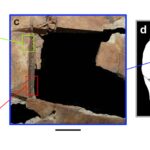 Έκαναν χειρουργικές επεμβάσεις εγκεφάλου πριν 3.500 χρόνια