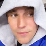 Ο Τζάστιν Μπίμπερ χαμογελά και πάλι, μετά την μερική παράλυση του προσώπου του