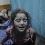 Γάζα: Εγχειρήσεις χωρίς αναισθητικό ακόμα και σε μικρά παιδιά