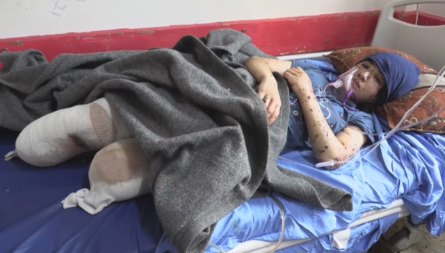 Φρίκη με τα ακρωτηριασμένα παιδιά στη Λωρίδα της Γάζας: «Ξαναβάλτε μου τα πόδια μου!»