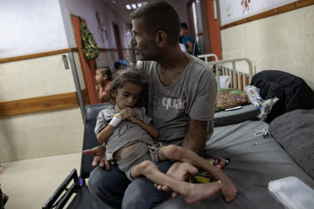 Πόλεμος στη Γάζα: Χιλιάδες παιδιά κάτω των 5 ετών υποφέρουν από οξύ υποσιτισμό