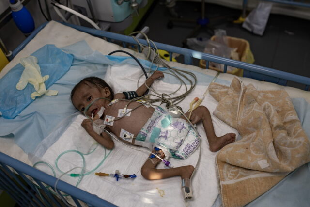 ΟΗΕ: Παιδιά στη Γάζα πεθαίνουν από την εκστρατεία λιμοκτονίας που πραγματοποιεί το Ισραήλ