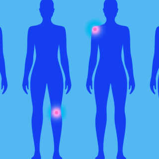 Μερικές αλήθειες για τη χρόνια φλεγμονή