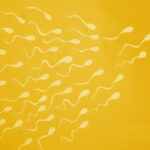 Έγινε σε νεαρό άνδρα η πρώτη μεταμόσχευση βλαστοκυττάρων που παράγουν σπέρμα