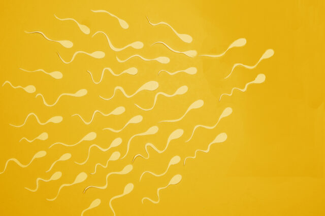 Έγινε σε νεαρό άνδρα η πρώτη μεταμόσχευση βλαστοκυττάρων που παράγουν σπέρμα