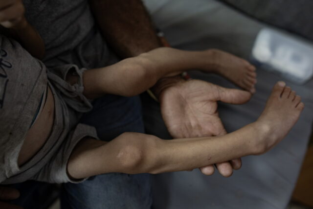 Γάζα: Ο ΟΗΕ προειδοποιεί πως 14.000 βρέφη κινδυνεύουν να πεθάνουν μέσα στις επόμενες 48 ώρες