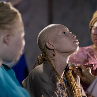 Ορατότητα στους ανθρώπους με αλμπινισμό: Ένα διαφορετικό fashion show στη Σενεγάλη