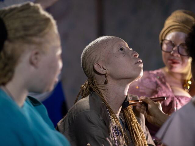 Ορατότητα στους ανθρώπους με αλμπινισμό: Ένα διαφορετικό fashion show στη Σενεγάλη