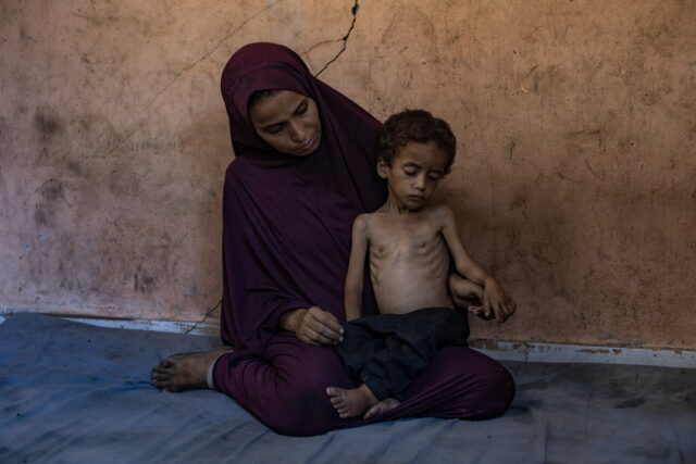 MSF: Ένα στα τέσσερα παιδιά στη Γάζα υποσιτίζεται