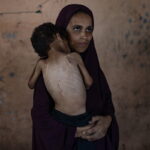 Η Γάζα πεινάει μέχρι θανάτου: Τουλάχιστον 19 νεκροί μέσα σε λίγα 24ωρα