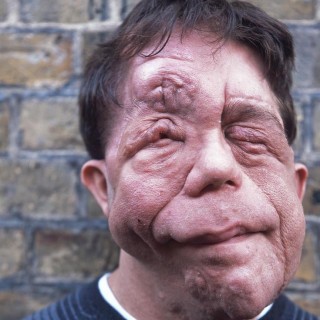 Άνταμ Πίρσον, η ομορφιά είναι κάτω από το δέρμα.